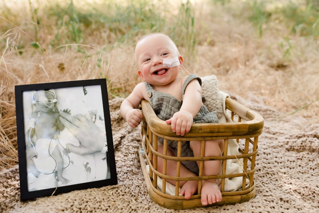 Smiling baby boy with feeding tube next to photo of twin brother